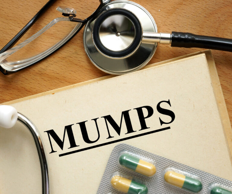 Mumps: Causes, Symptoms & Treatments
